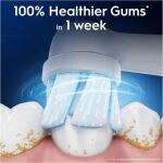 Oral-B Aufsteckbürsten iO Sanfte Reinigung 8er FFU