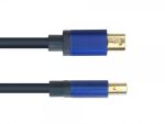 Alcasa MDP-HDMI2 Videokabel-Adapter 0,2 m Mini DisplayPort HDMI Schwarz, Blau